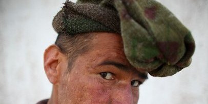 عکس هایی از بیماران روانی در افغانستان