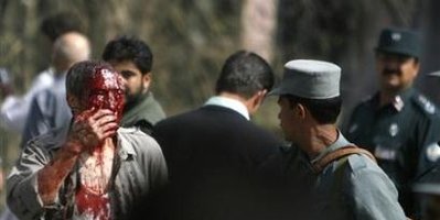 صحنه های خونین انفجار دوشنبه از چشم دوربین